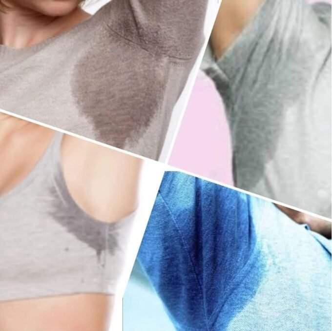 hyperhidrosis